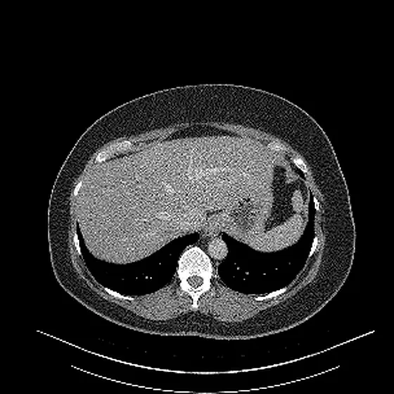 One picture from the sample CT scan: a slice across the body, with its edges labelled front, back, right side and left side.