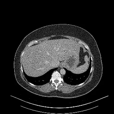 A slice of the sample CT scan.